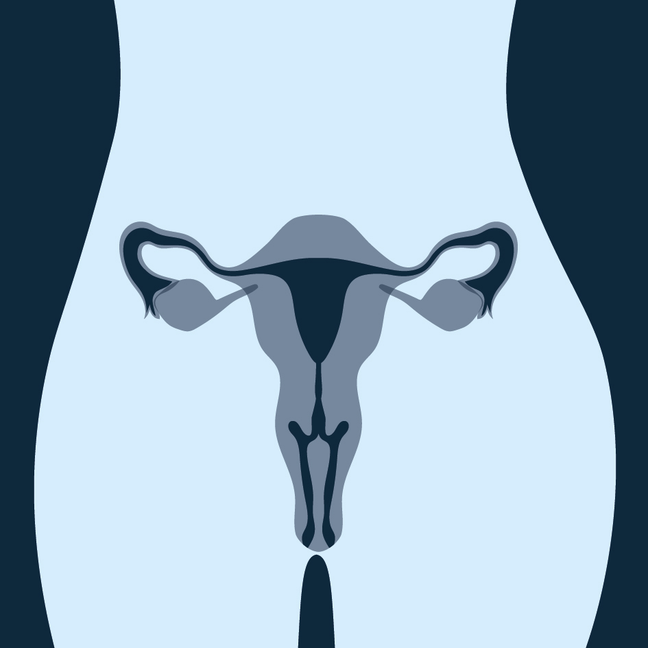 Gynaecologische kanker