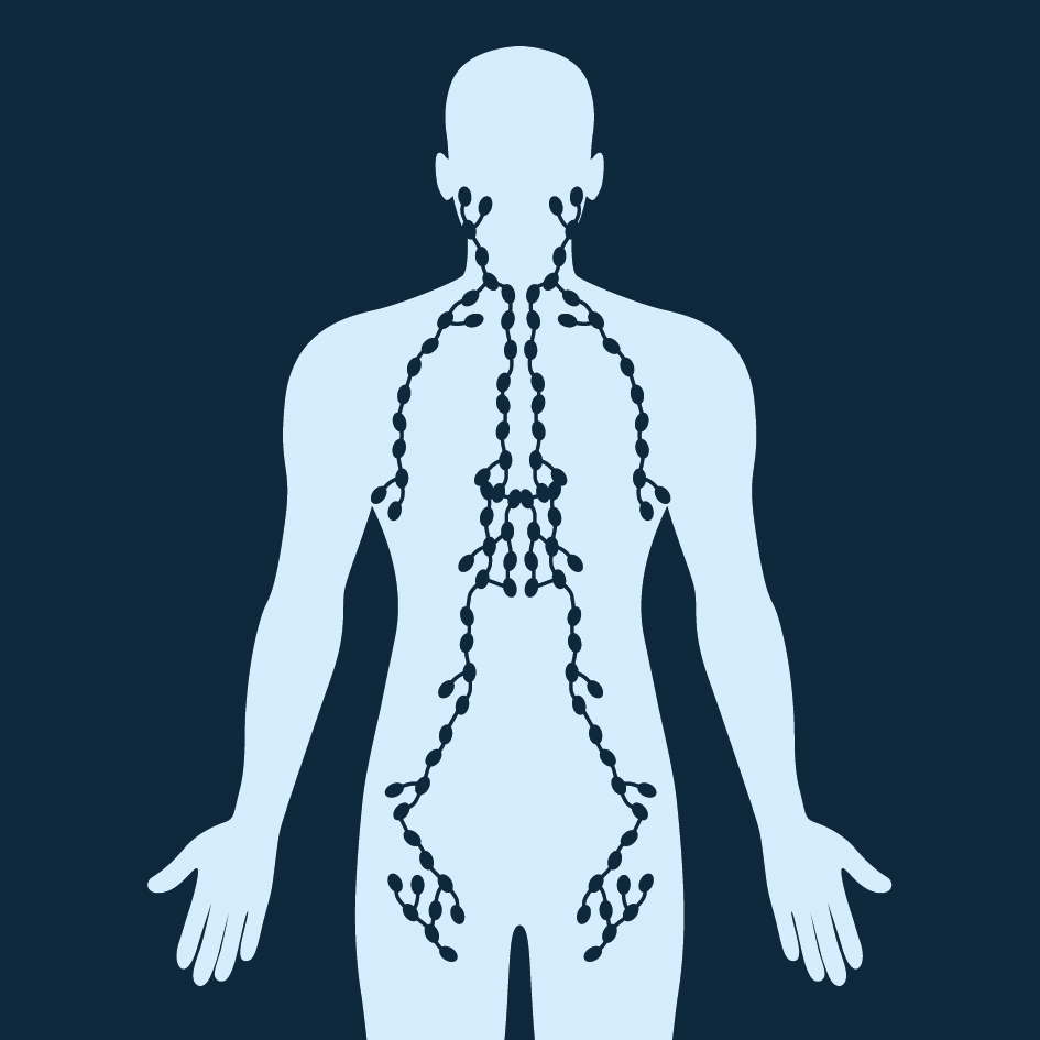 Bloed- en lymfeklierkanker