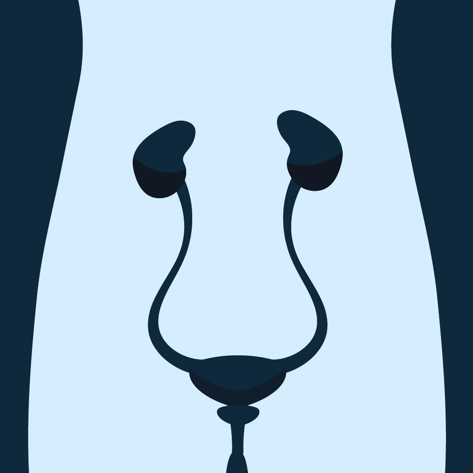 Kanker van de urinewegen